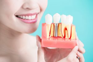 Restorative Dentistry 